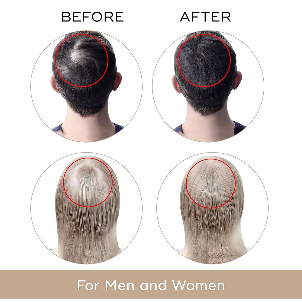 Casco láser crecimiento del cabello 272