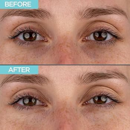 Micro needling serum ögonlappar