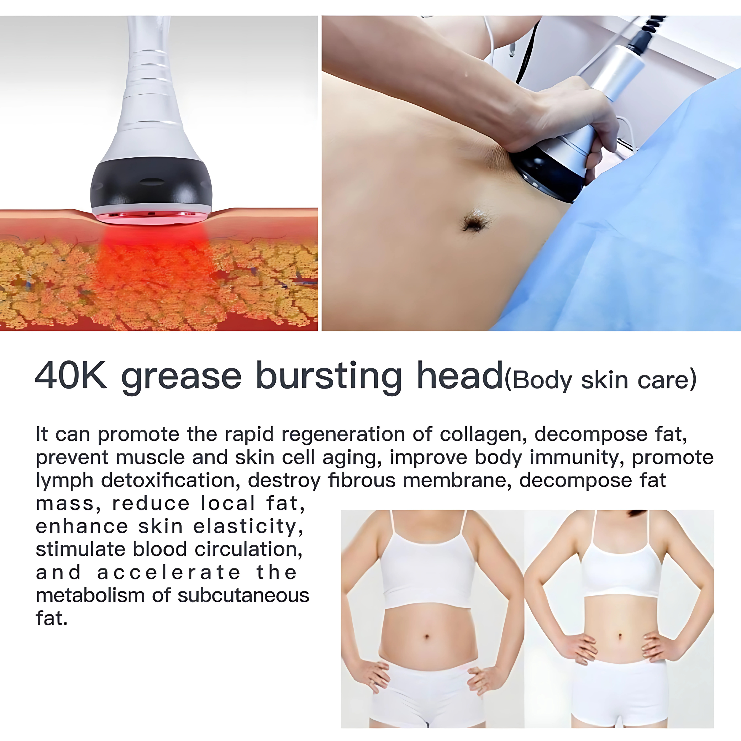 Quemagrasas Ultrasone 40K
