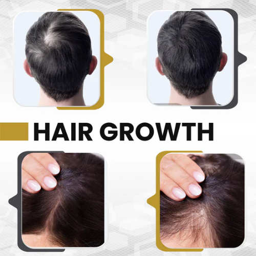 Casco láser crecimiento del cabello 272